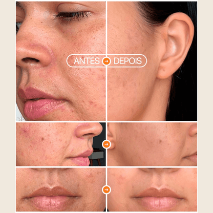 Bastão Antimarcas 11g - Biobio